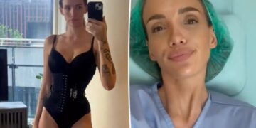 Bravo alum shares results of ‘rib recontouring’ procedure to get ‘snatched waist’: ‘Best thing I’ve done’