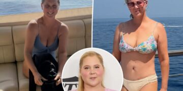 Bikini-clad Amy Schumer shows off dramatic weight loss in new unfiltered photos