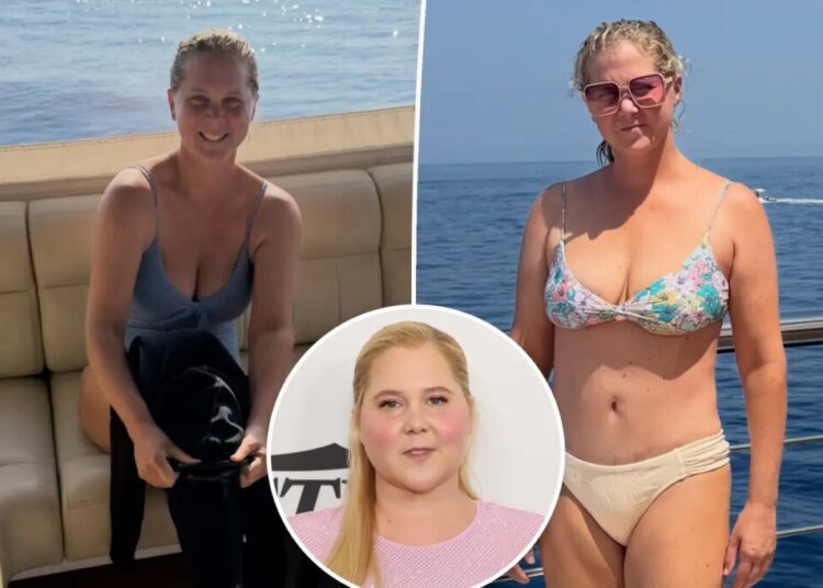 Bikini-clad Amy Schumer shows off dramatic weight loss in new unfiltered photos