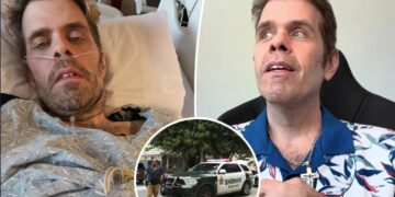 Perez Hilton’s friends fear lengthy sepsis battle triggered horrifying self-harm incident
