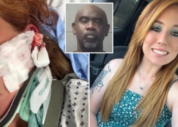 DoorDash mom left with skull fractures, brain bleeds after man allegedly follows her and attacks with bat