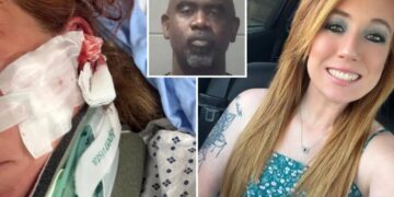 DoorDash mom left with skull fractures, brain bleeds after man allegedly follows her and attacks with bat