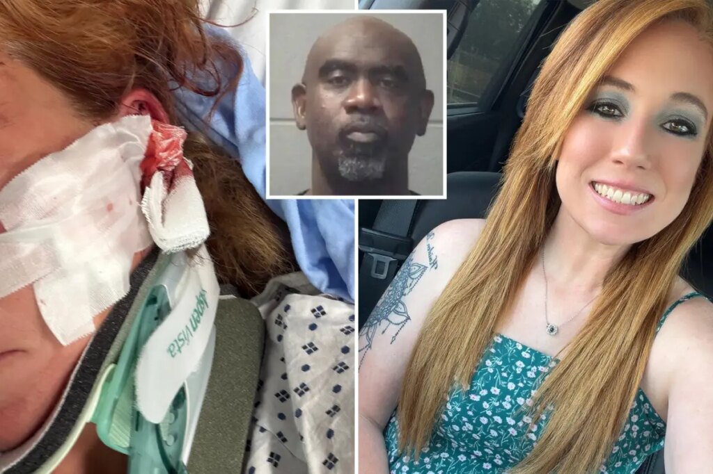 DoorDash mom left with skull fractures, brain bleeds after man allegedly follows her and attacks with bat