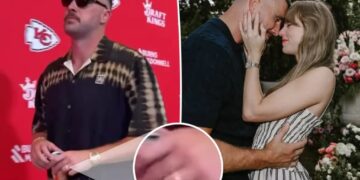 Travis Kelce proudly shows off wedding band ahead of first Chiefs game since wedding to Taylor Swift
