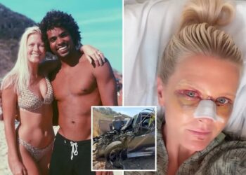Top surfer and his wife show their horrific injuries after being mangled in California crash
