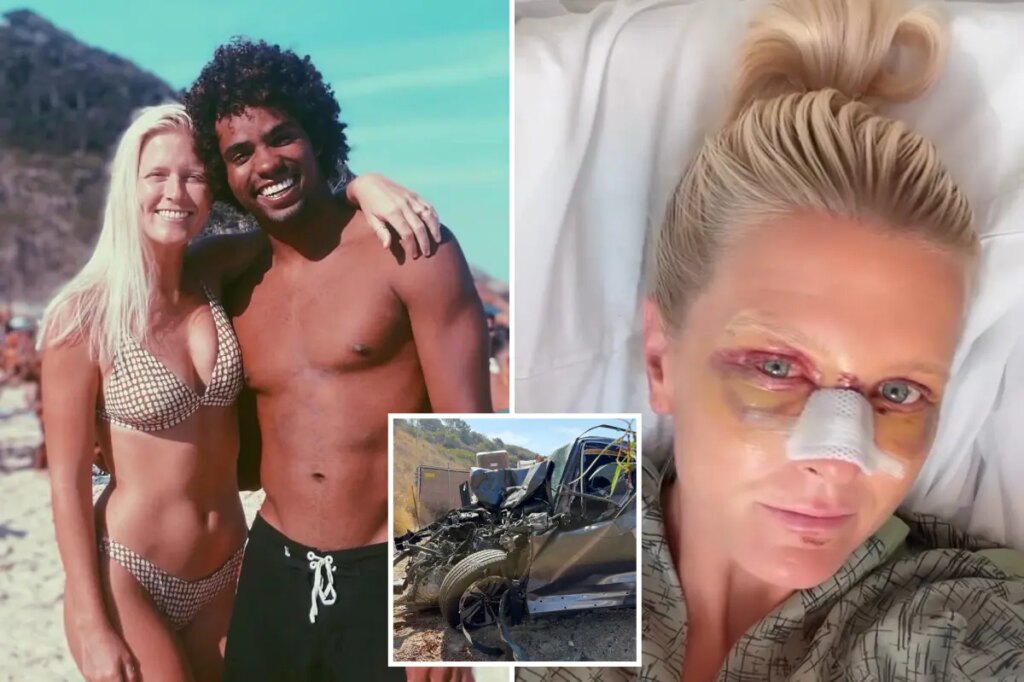 Top surfer and his wife show their horrific injuries after being mangled in California crash