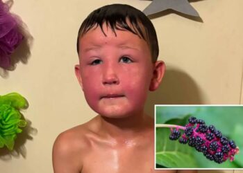Midwest boy, 7, nearly dies over poisonous weeds in his backyard