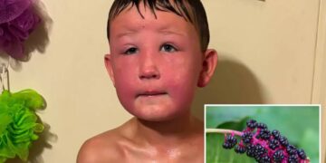 Midwest boy, 7, nearly dies over poisonous weeds in his backyard