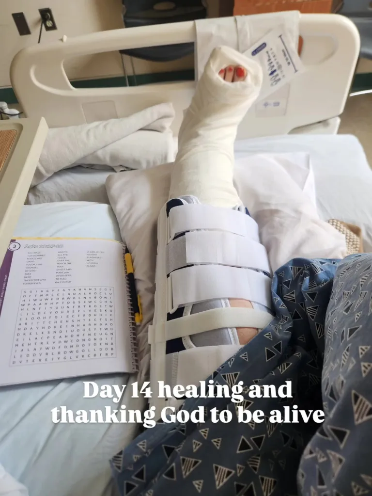 A person in a hospital bed with one leg in a cast and the other in a brace, with a word search puzzle book and text overlay 