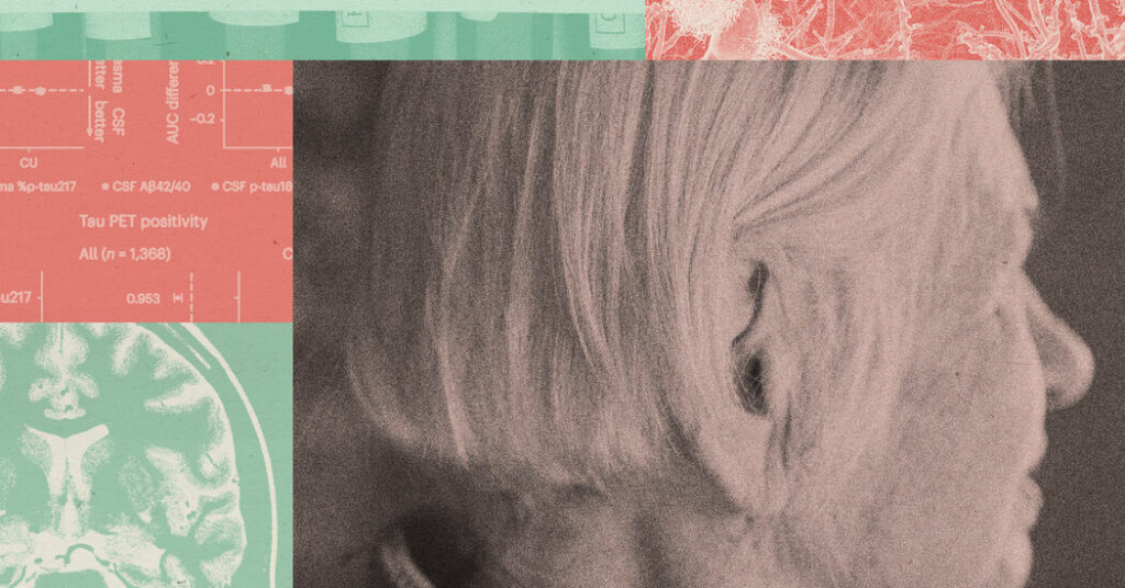 New Alzheimer’s Test Is Cause for Hope and Caution