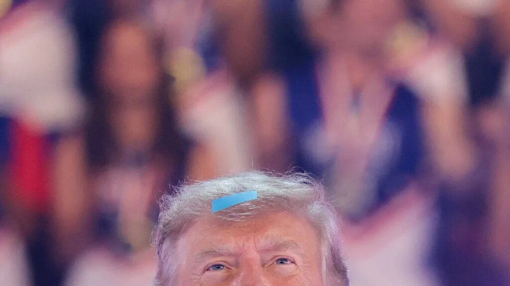 Trump’s vicious taunt highlights a severe psychological sickness