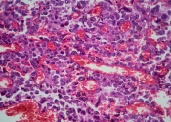 The screenings and other habits doctors recommend as early-onset cancers rise