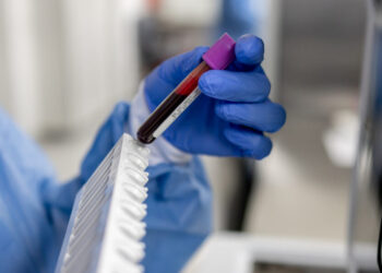I’m an oncologist. Every man should know this about prostate cancer.