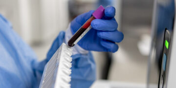I’m an oncologist. Every man should know this about prostate cancer.
