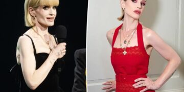 ‘Sick’ Kelly Osbourne details ‘slow process’ of recovery as she addresses body-shaming comments: ‘I wasn’t well’