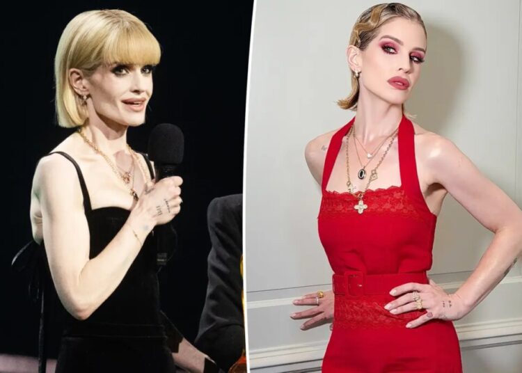 ‘Sick’ Kelly Osbourne details ‘slow process’ of recovery as she addresses body-shaming comments: ‘I wasn’t well’