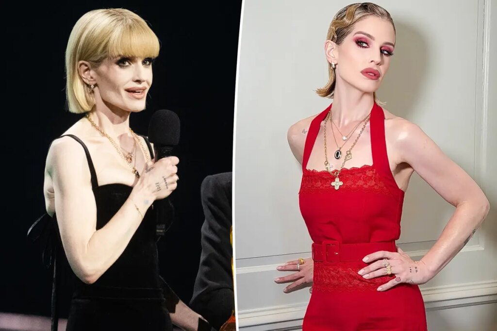 ‘Sick’ Kelly Osbourne details ‘slow process’ of recovery as she addresses body-shaming comments: ‘I wasn’t well’