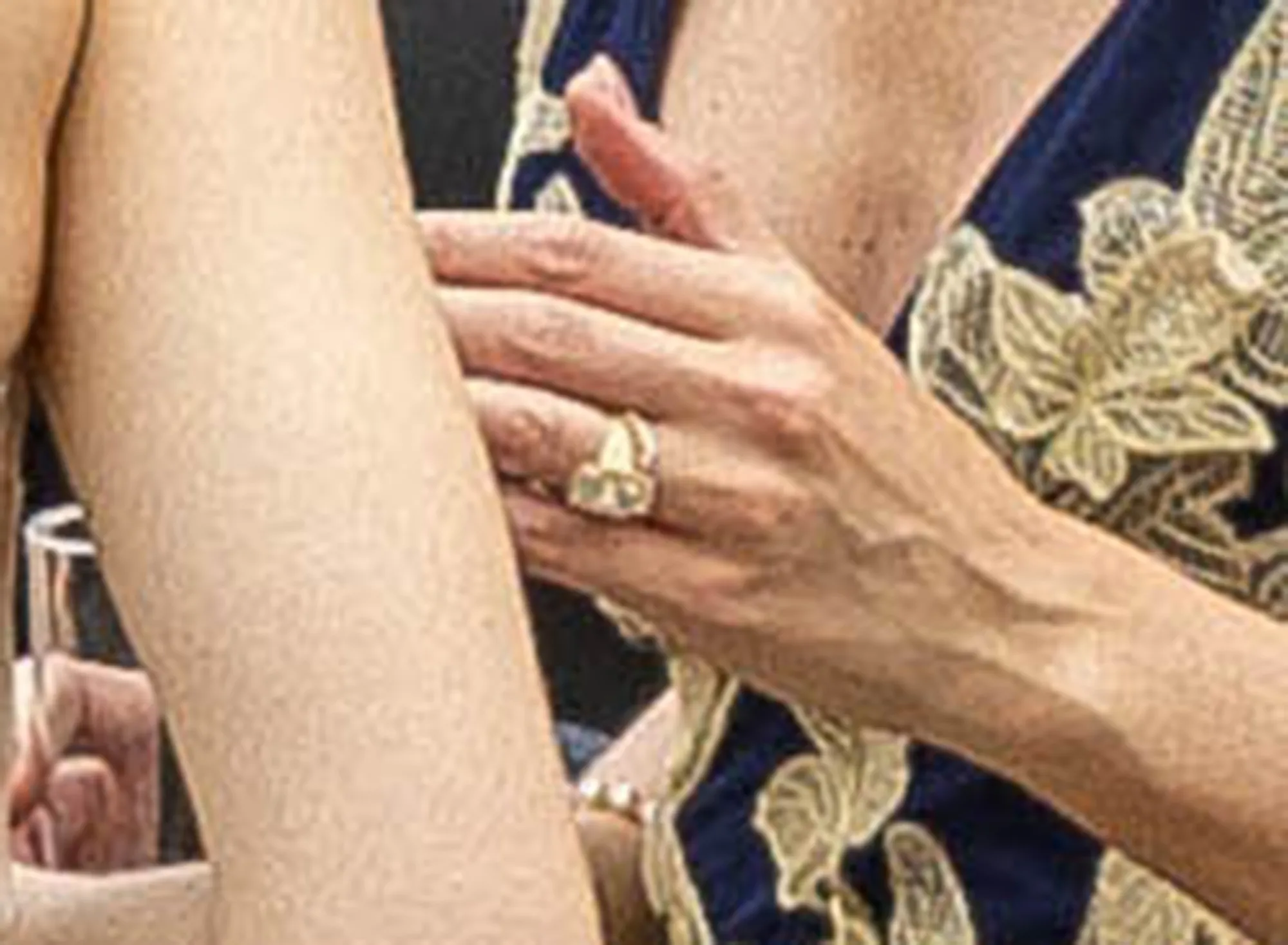 Close-up of a guest's hand wearing a ring and bracelet, touching an arm.