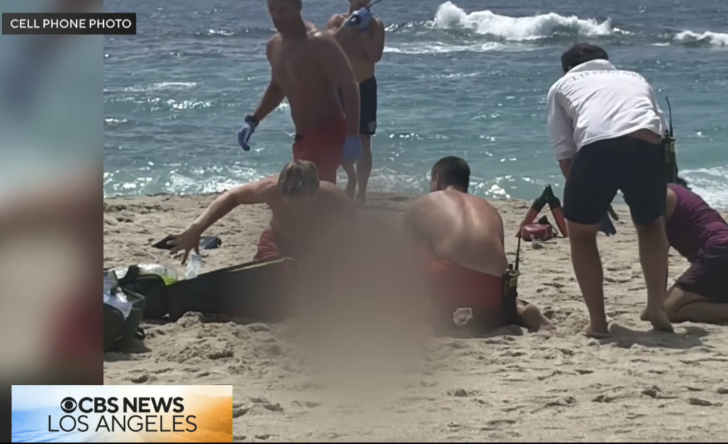 Lifeguards attending to a nearly drowned woman on Aliso Beach.