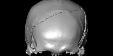A 14th-Century Skeleton Had Injuries That Looked Like a Car Crash. What Killed Him?