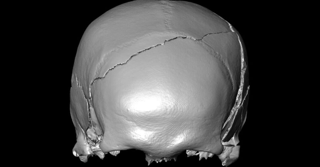 A 14th-Century Skeleton Had Injuries That Looked Like a Car Crash. What Killed Him?