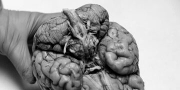 5 Takeaways on the Fallout From an Alarming C.T.E. Study