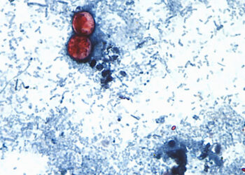 I study pathogens in sewage. Here’s how cyclospora could be getting into our food.