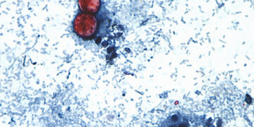 I study pathogens in sewage. Here’s how cyclospora could be getting into our food.