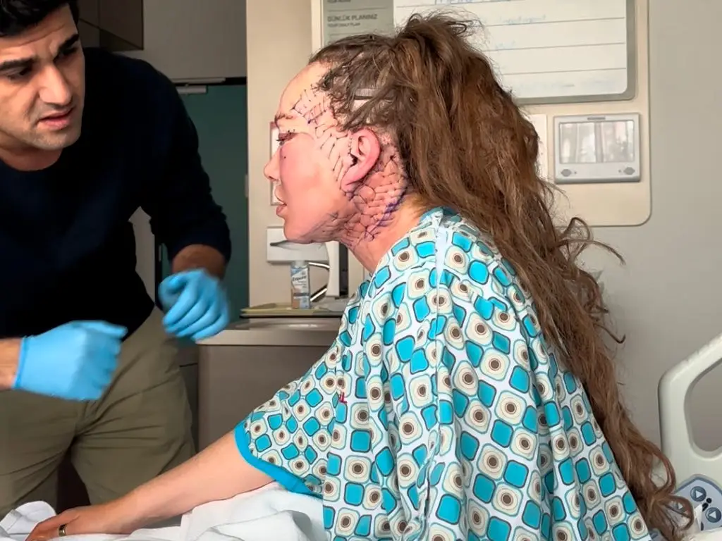 A woman in a hospital bed after a facelift.