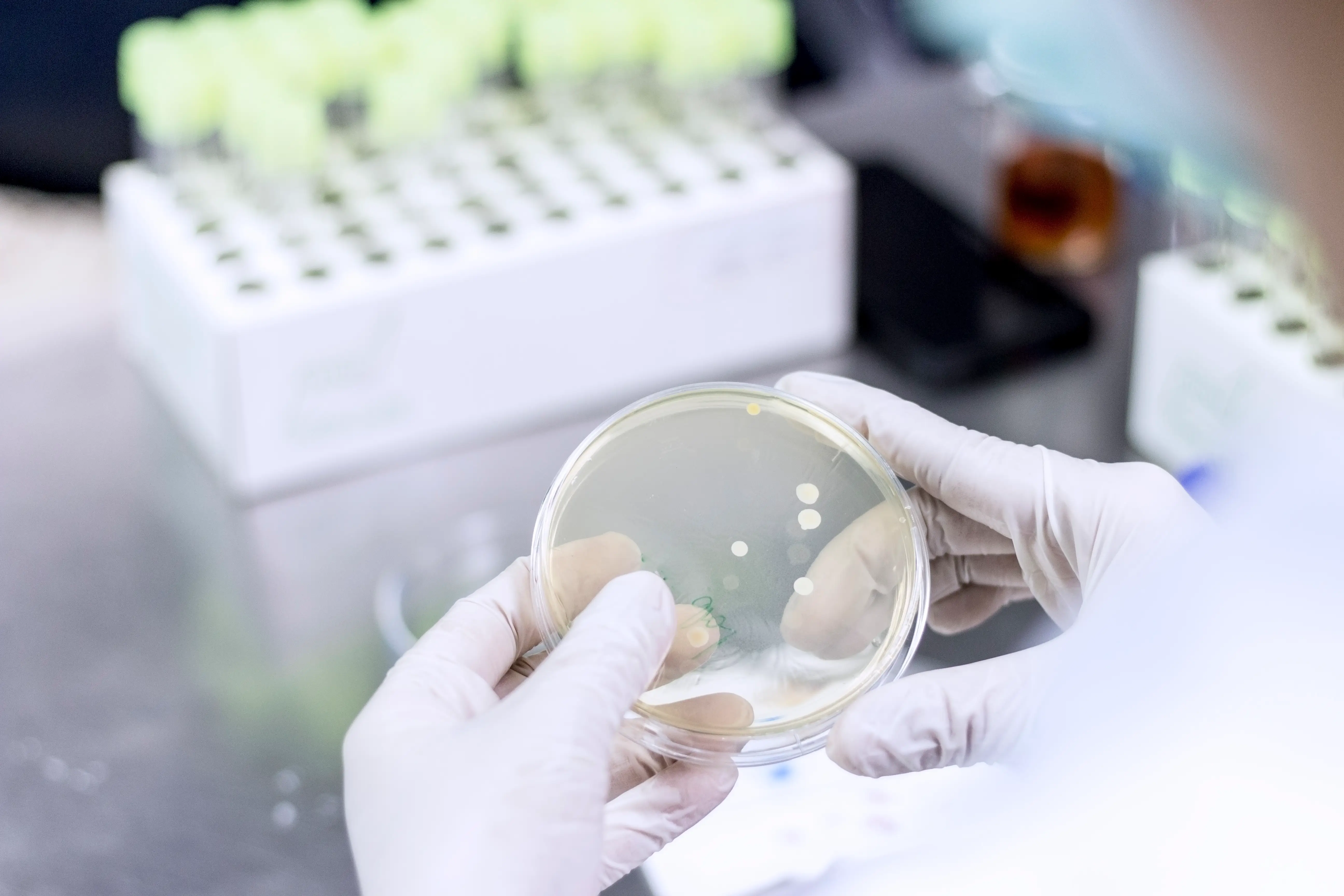 E. coli and Salmonella can be grown and tested in a lab, making it easier to connect the dots between illnesses.
