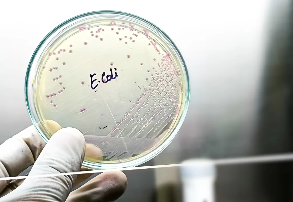 Petri dish with E.coli colonies.