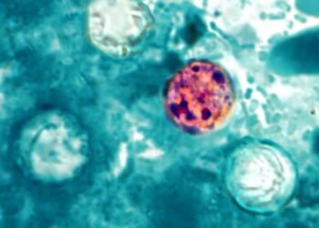 CDC Says Cyclospora Outbreak Has Reached 45 States