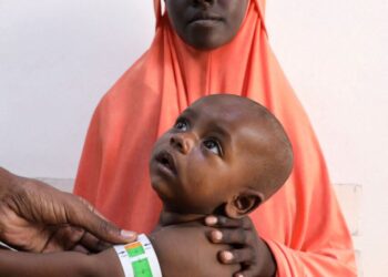 Severe malnutrition in Somalia is surging after U.S. cuts, aid groups say