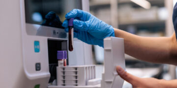 The sneaky kind of cholesterol that may be threatening your heart health