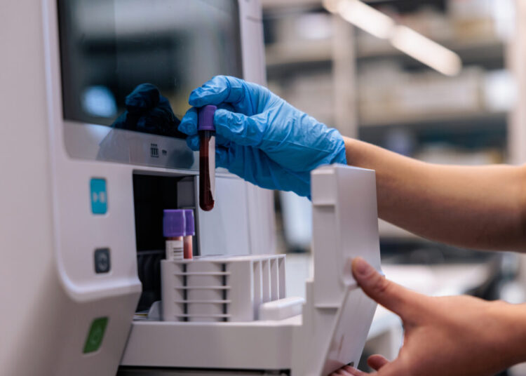The sneaky kind of cholesterol that may be threatening your heart health