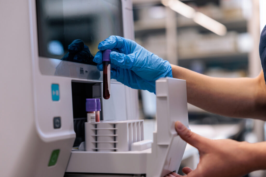 The sneaky kind of cholesterol that may be threatening your heart health