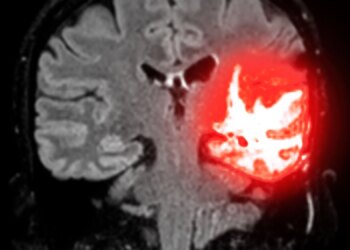Nearly 1 in 4 NFL Players Who Died Had CTE, New Study Finds