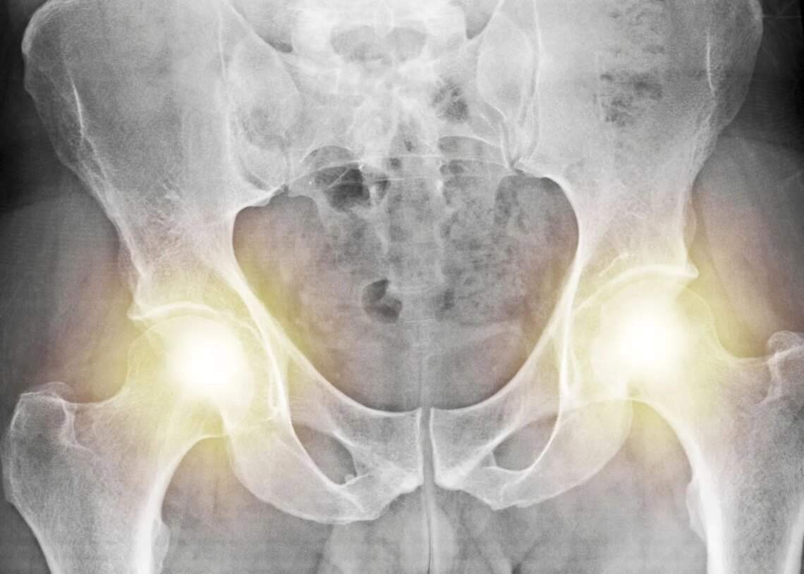 The Weird Evolutionary Reason Men and Women Have Different Pelvises