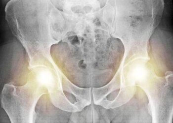 The Weird Evolutionary Reason Men and Women Have Different Pelvises