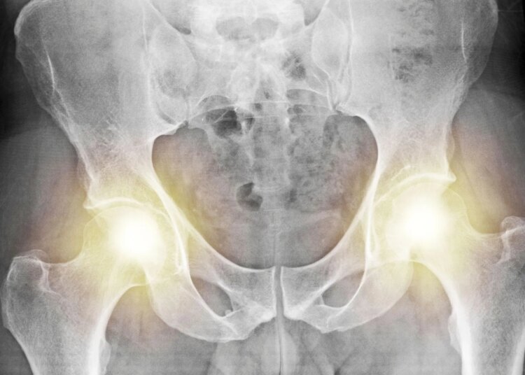 The Weird Evolutionary Reason Men and Women Have Different Pelvises