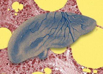 There’s a Fatty Liver Epidemic. AI Could Help Get Ahead of It
