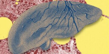 There’s a Fatty Liver Epidemic. AI Could Help Get Ahead of It