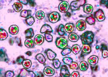 2 measles-related deaths reported in Pennsylvania, the state’s first in 35 years