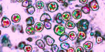 2 measles-related deaths reported in Pennsylvania, the state’s first in 35 years