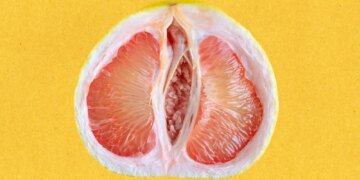 Why More Women Are Getting Labiaplasty, and What Experts Want Them to Know