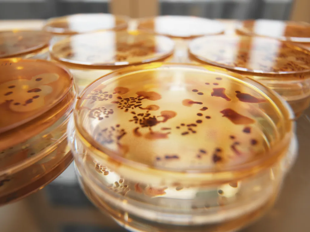 A close up of a slide with Campylobacter bacteria organisms in petri dishes