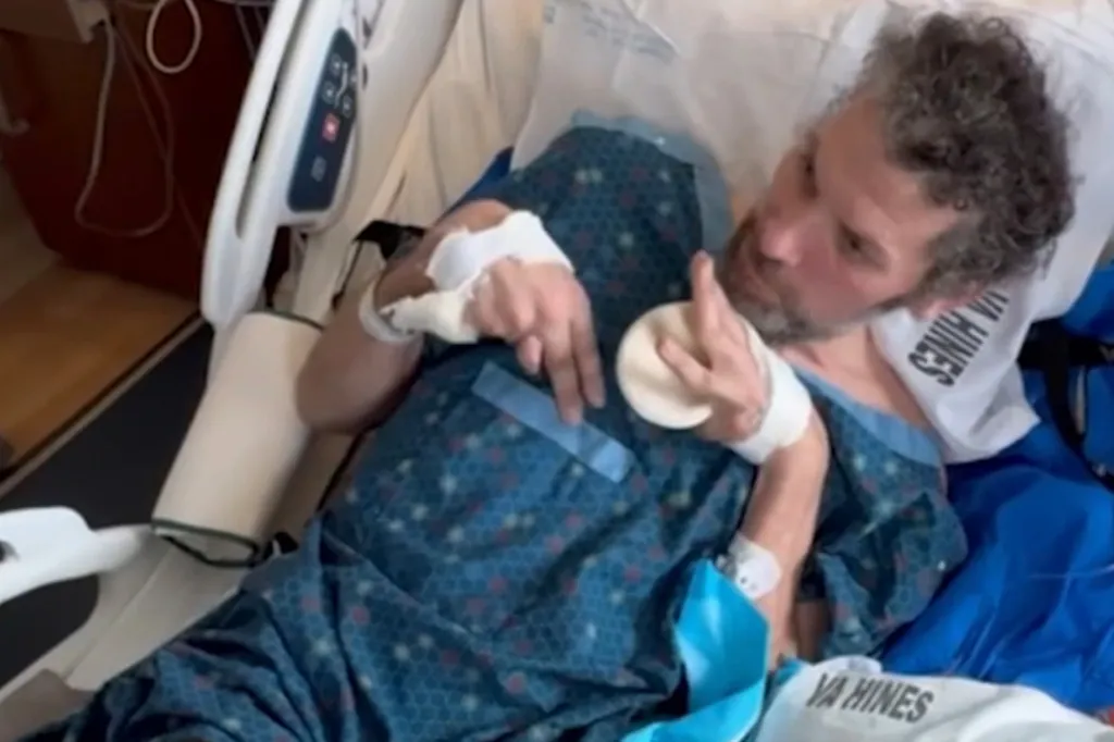 Joe Belgio, 44, suffered permanent brain damage after allegedly eating contaminated oysters at a Chicago-area steakhouse, a lawsuit says.