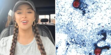 TikTok food critic, 29, details ‘miserable’ experience of contracting ‘explosive diarrhea’ parasite