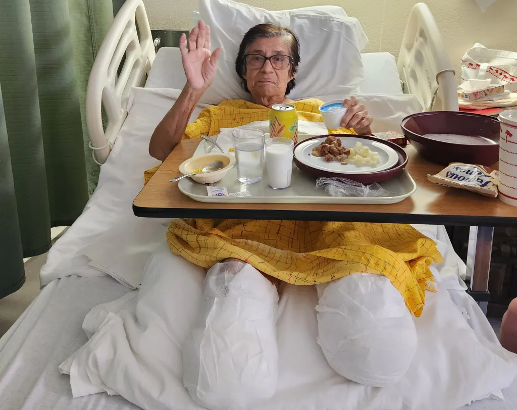 Cristina Vargas in a hospital bed with bandaged legs, holding her hand up, with a meal tray in front of her.