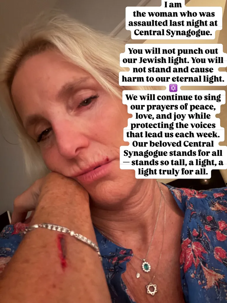 A woman with a cut on her lip and a deep gash on her arm, wearing a Star of David necklace, with text about an assault at Central Synagogue.